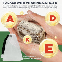 Raw African Black Soap for Oily Skin, Dark Spots  Pure & Natural Ingredients - Organic  Face and Body Wash Soap